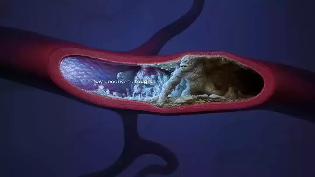 平面广告创意风暴：这些案例让你瞬间灵感爆棚！